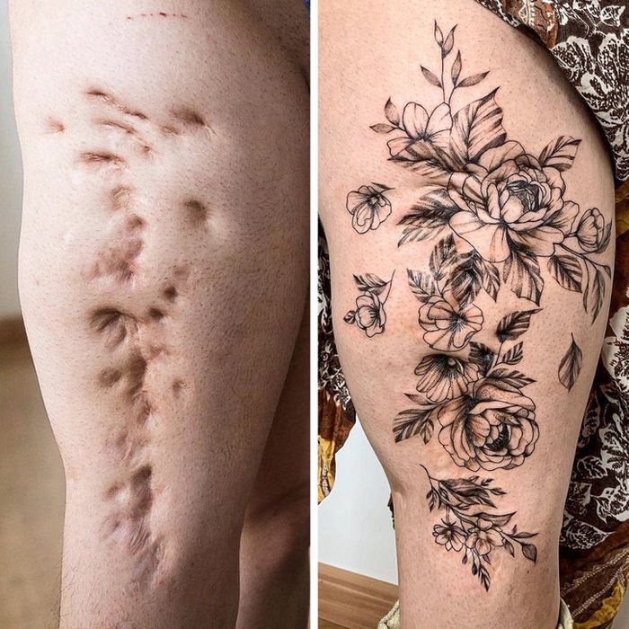 15 pessoas que recuperaram a confiança após transformar suas cicatrizes em tatuagem 3