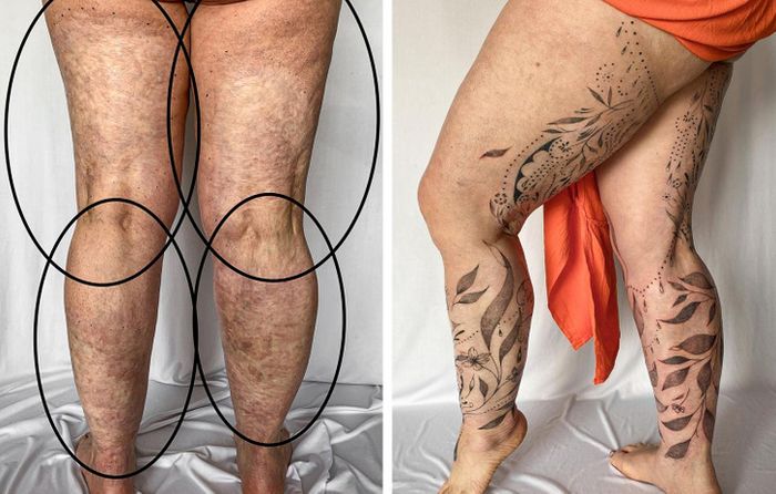 15 pessoas que recuperaram a confiança após transformar suas cicatrizes em tatuagem 4