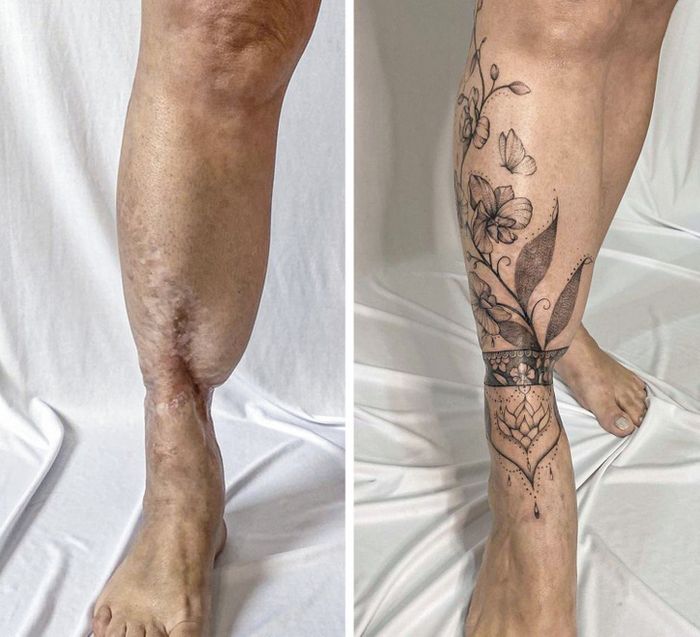 15 pessoas que recuperaram a confiança após transformar suas cicatrizes em tatuagem 5