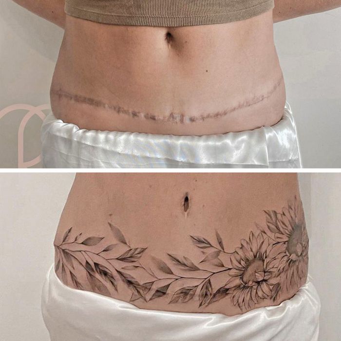 15 pessoas que recuperaram a confiança após transformar suas cicatrizes em tatuagem 5