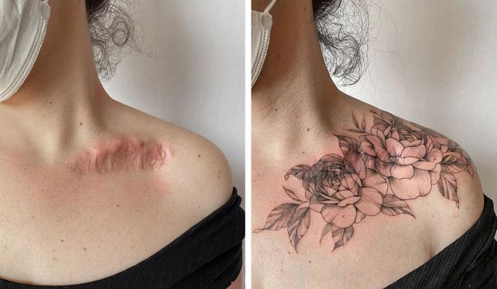 15 pessoas que recuperaram a confiança após transformar suas cicatrizes em tatuagem 7