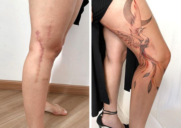 15 pessoas que recuperaram a confiança após transformar suas cicatrizes em tatuagem 8