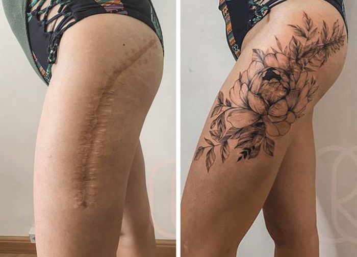 15 pessoas que recuperaram a confiança após transformar suas cicatrizes em tatuagem 8