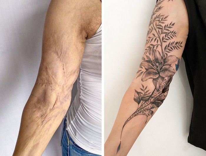 15 pessoas que recuperaram a confiança após transformar suas cicatrizes em tatuagem 10