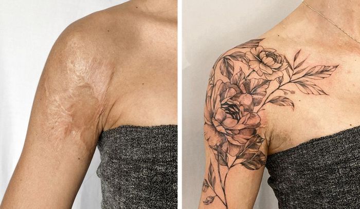 15 pessoas que recuperaram a confiança após transformar suas cicatrizes em tatuagem 12