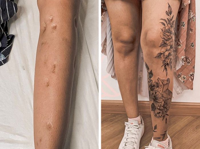 15 pessoas que recuperaram a confiança após transformar suas cicatrizes em tatuagem 12