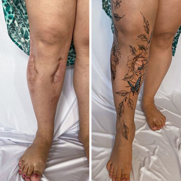 15 pessoas que recuperaram a confiança após transformar suas cicatrizes em tatuagem 13