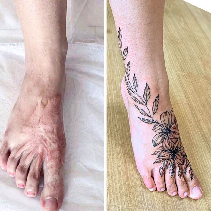 15 pessoas que recuperaram a confiança após transformar suas cicatrizes em tatuagem 16