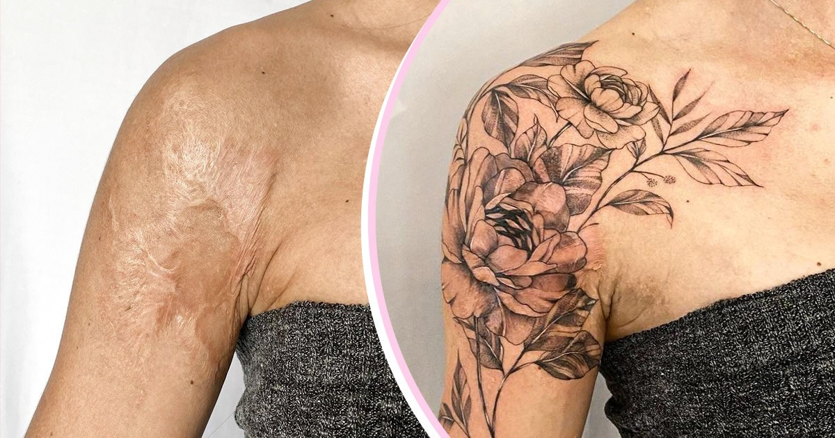 15 pessoas que recuperaram a confiança após transformar suas cicatrizes em tatuagem