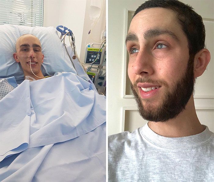 36 fotos antes e depois de homens que abandonaram as navalhas e deixaram suas barbas crescerem livremente 21