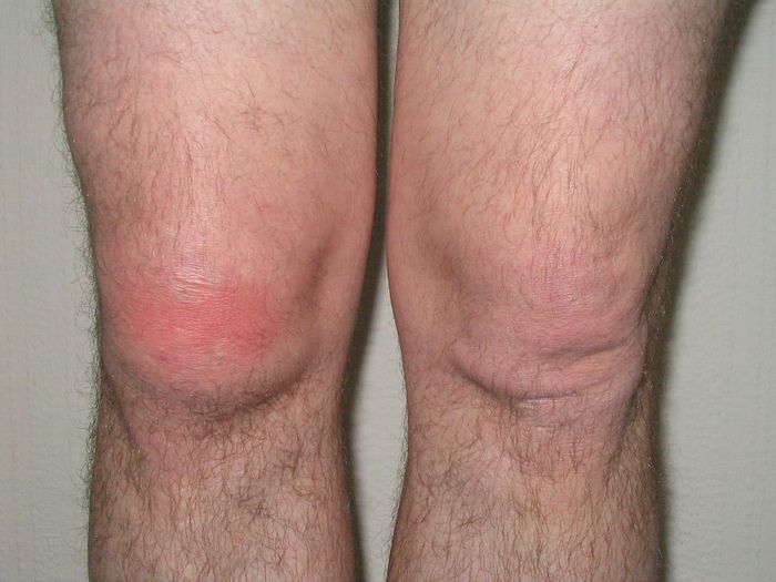 10 partes do corpo que doem por causa de pensamentos negativos 7