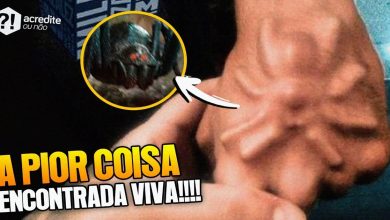 5 coisas que já foram encontradas vivendo dentro de pessoas 3