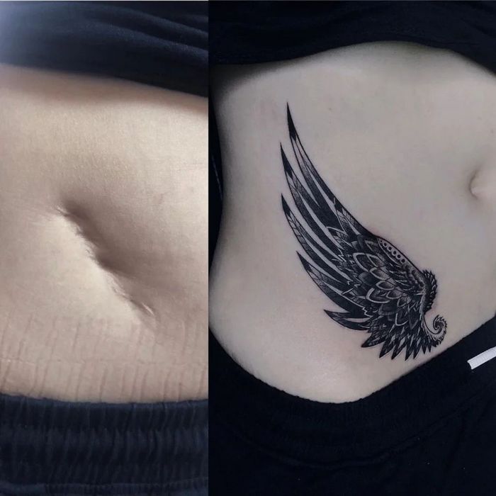 48 tatuagens incríveis que transformam marcas de nascença e cicatrizes em arte impressionante 7