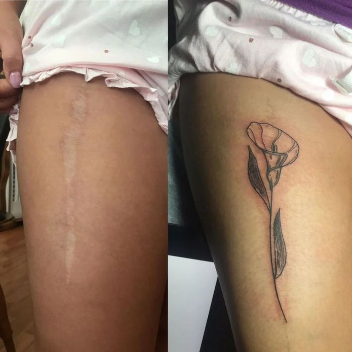 48 tatuagens incríveis que transformam marcas de nascença e cicatrizes em arte impressionante 18