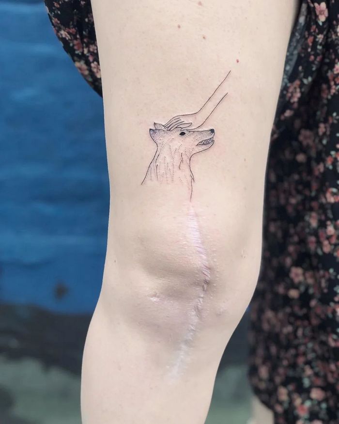 48 tatuagens incríveis que transformam marcas de nascença e cicatrizes em arte impressionante 43