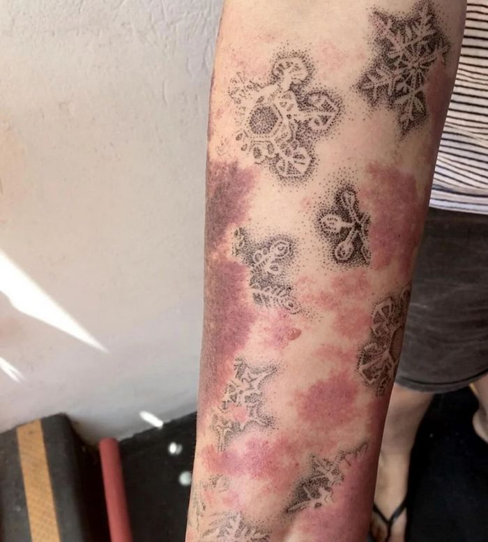 48 tatuagens incríveis que transformam marcas de nascença e cicatrizes em arte impressionante 44