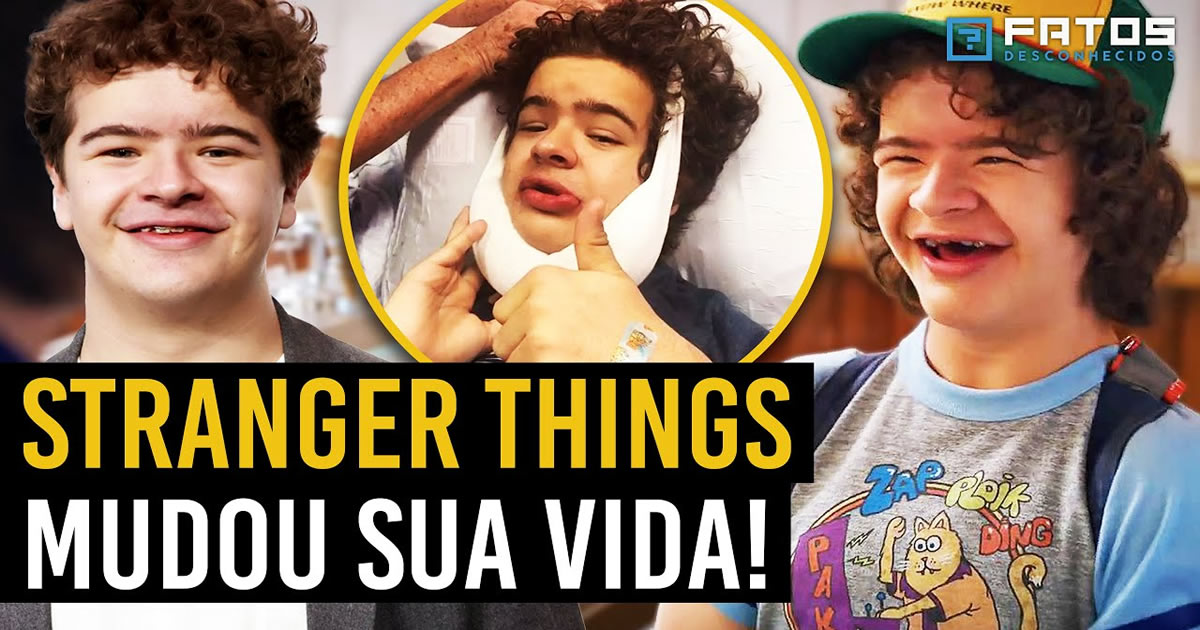 A doença rara de Gaten Matarazzo, o Dustin de Stranger Things
