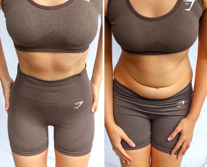 Padrões de beleza: Foto real Vs Foto editadas (34 fotos) 7