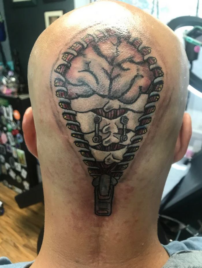 16 pessoas que usaram a arte das tatuagens para cobrir suas cicatrizes 1 16 pessoas que usaram a arte das tatuagens para cobrir suas cicatrizes 1