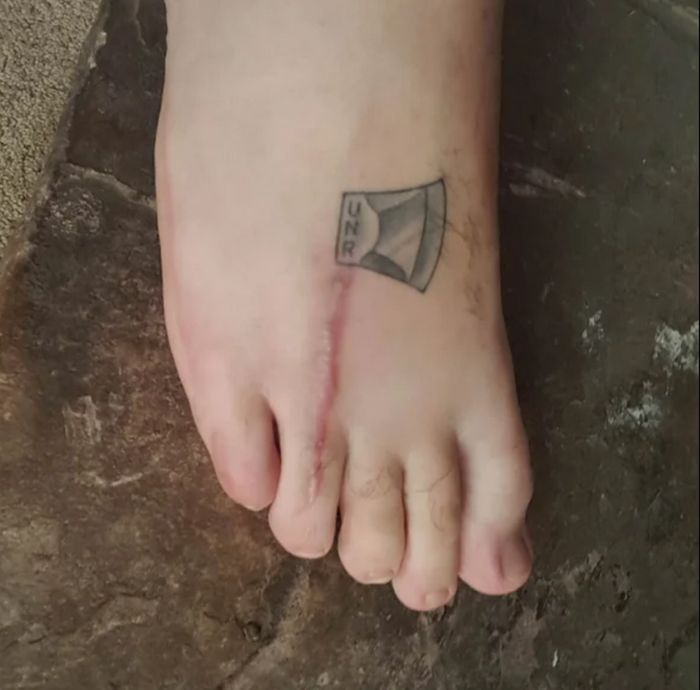 16 pessoas que usaram a arte das tatuagens para cobrir suas cicatrizes 13 16 pessoas que usaram a arte das tatuagens para cobrir suas cicatrizes 13