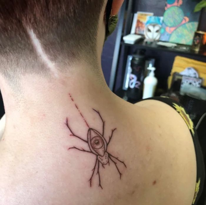 16 pessoas que usaram a arte das tatuagens para cobrir suas cicatrizes 15