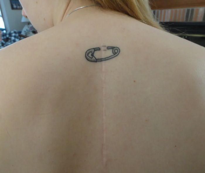 16 pessoas que usaram a arte das tatuagens para cobrir suas cicatrizes 16