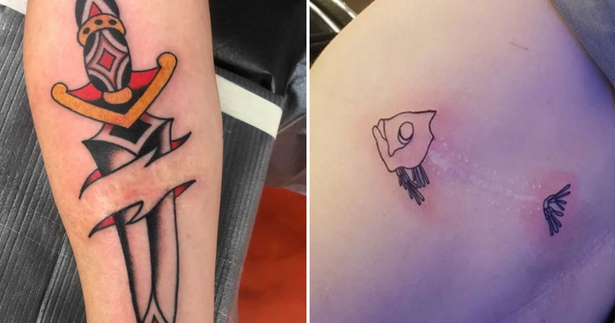 16 pessoas que usaram a arte das tatuagens para cobrir suas cicatrizes