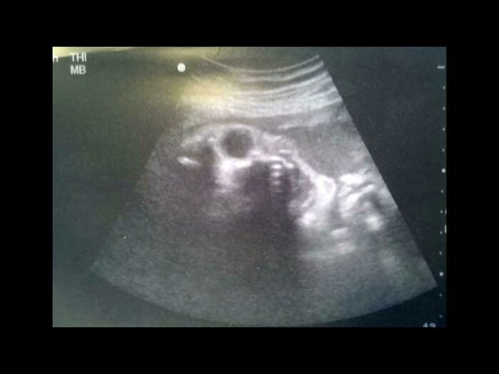 32 pessoas viram essas imagens amaldiçoadas e tiveram que compartilhá-las neste grupo online 27