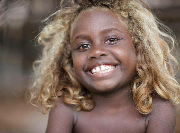42 fotos de pessoas abençoadas com genética única 2 42 fotos de pessoas abençoadas com genética única 2