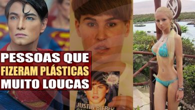 Pessoas que fizeram plásticas muito loucas 6