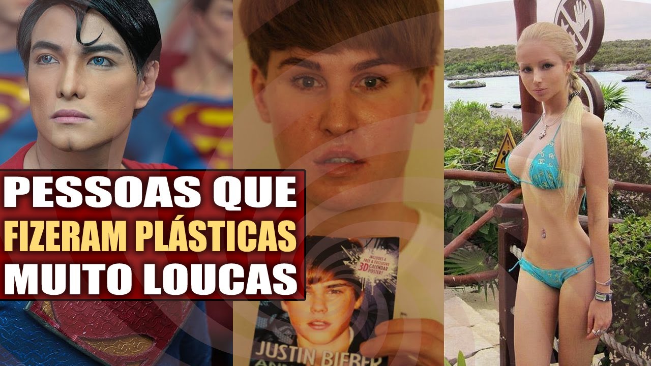 Pessoas que fizeram plásticas muito loucas