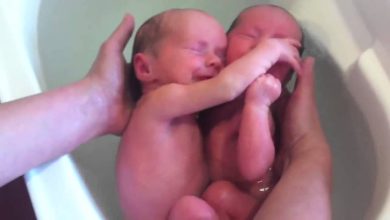 Bebês Gêmeos nascem e não percebem. Emocionante demais 7