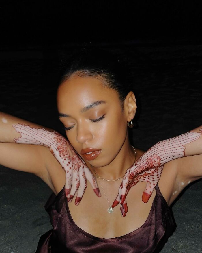 Amara Aleman: Transformando o vitiligo em arte e inspiração (20 fotos) 6