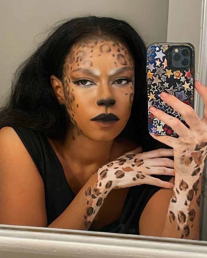 Amara Aleman: Transformando o vitiligo em arte e inspiração (20 fotos) 9
