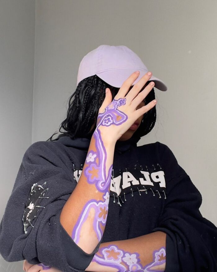 Amara Aleman: Transformando o vitiligo em arte e inspiração (20 fotos) 12