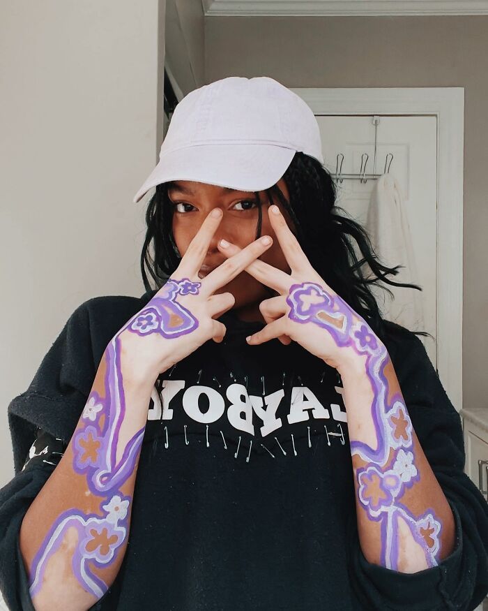 Amara Aleman: Transformando o vitiligo em arte e inspiração (20 fotos) 18