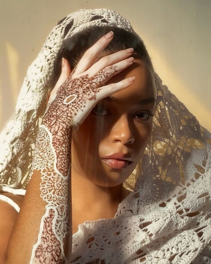 Amara Aleman: Transformando o vitiligo em arte e inspiração (20 fotos) 19