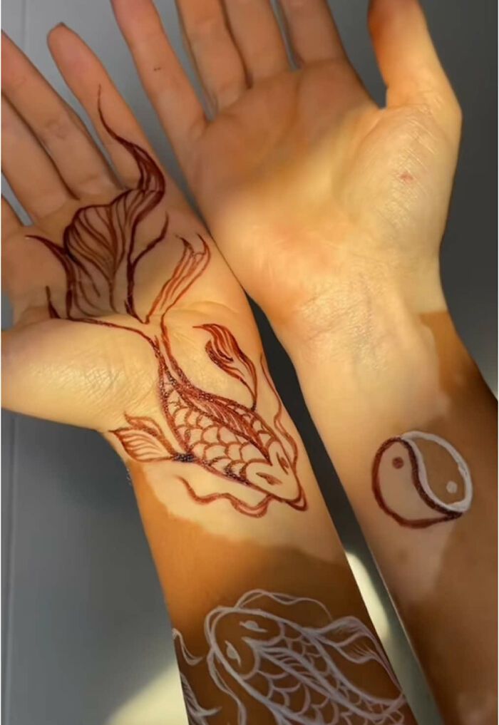 Amara Aleman: Transformando o vitiligo em arte e inspiração (20 fotos) 20